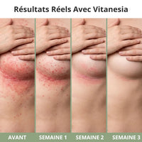 Crème pour plis cutanés