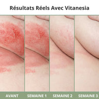 Crème pour plis cutanés