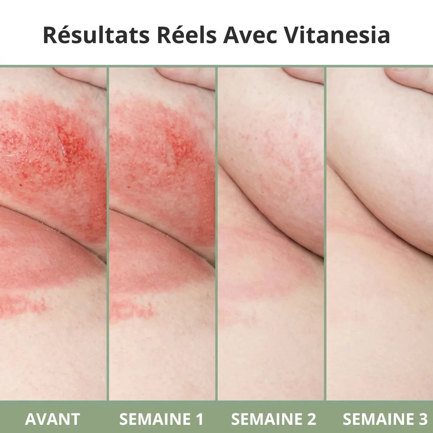 Crème pour plis cutanés