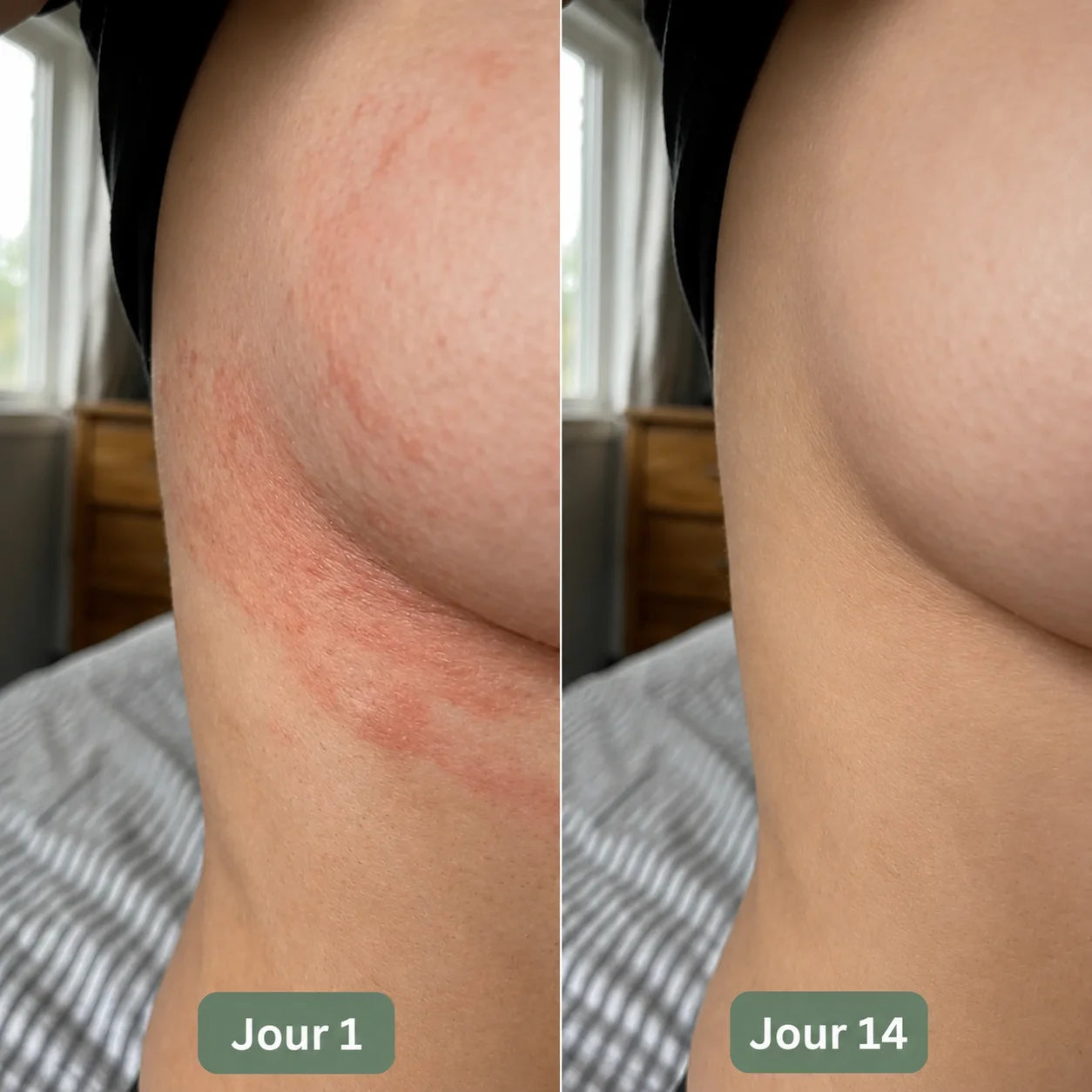 Crème pour plis cutanés