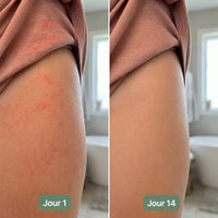 Crème pour plis cutanés